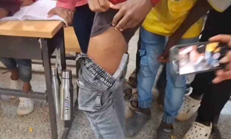 Principal assaults students inside residential school room in Chikmagalur