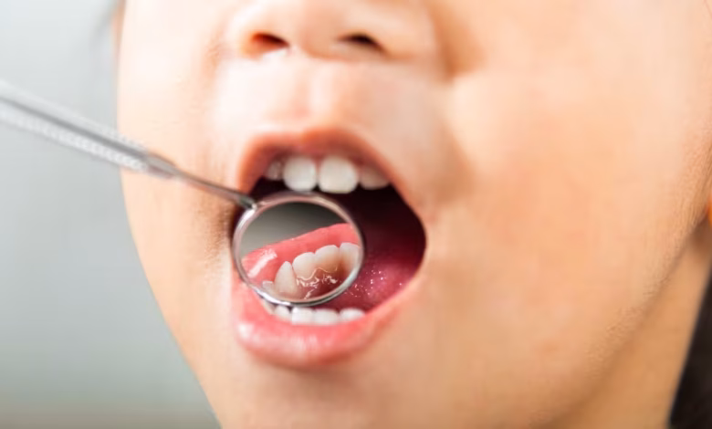 Simple Daily Habits Can Help Prevent Tooth Pain and Improve Oral Health