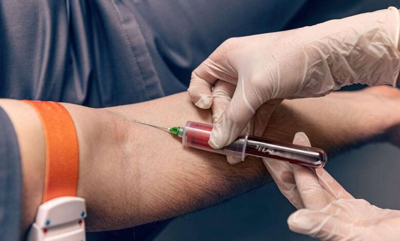 Essential Annual Blood Tests Every Woman Should Get for Better Health Early Detection and Long Term Wellness