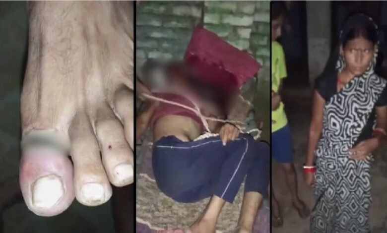 Woman Arrested After Allegedly Tying Husband to Cot and Giving Electric Shocks