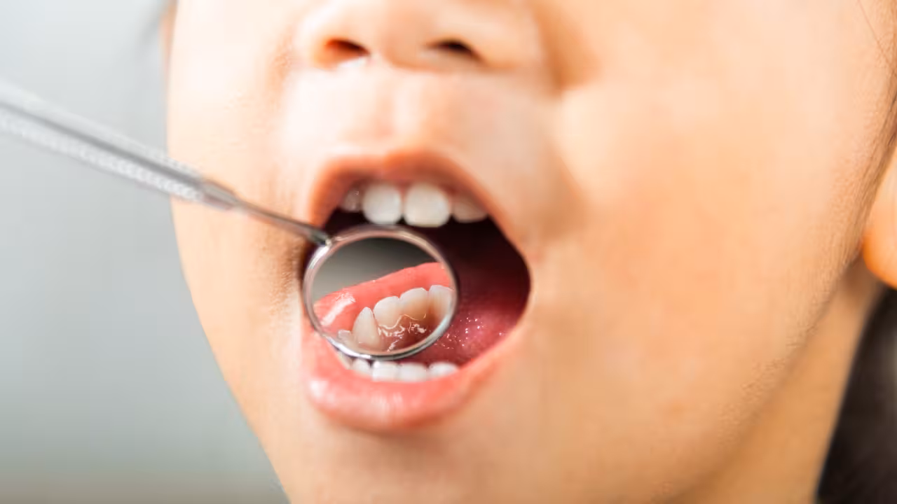 Simple Daily Habits Can Help Prevent Tooth Pain and Improve Oral Health