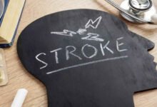 Study Links Certain Blood Groups to Higher Stroke Risk at Young Age