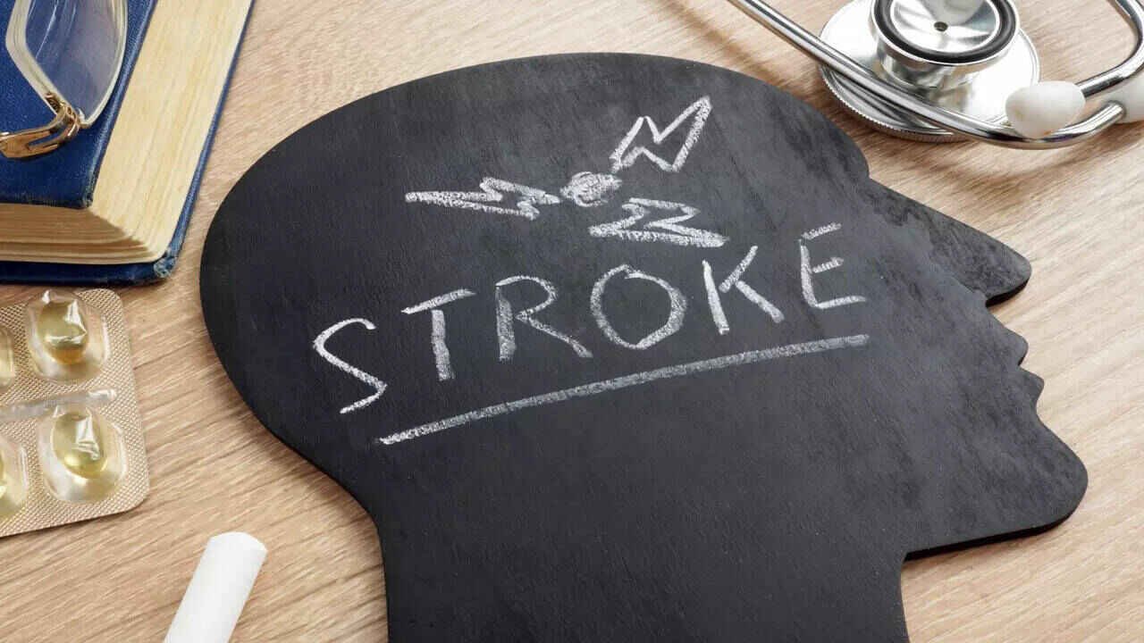 Study Links Certain Blood Groups to Higher Stroke Risk at Young Age