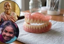 Dental Health in Old Age Experts Explain Why Teeth Fall Out and How to Prevent It