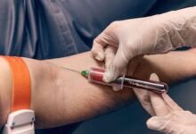Essential Annual Blood Tests Every Woman Should Get for Better Health Early Detection and Long Term Wellness