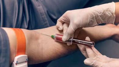 Essential Annual Blood Tests Every Woman Should Get for Better Health Early Detection and Long Term Wellness