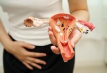 Menstrual Health Awareness Needs Urgent Workplace and Social Reform Across India