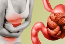 Modern Lifestyle Habits Are Quietly Damaging Digestive Health