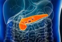 Scientists Develop Bioengineered Mini Pancreas That Could Transform Diabetes Treatment