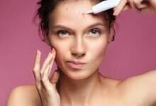Why Pimples Appear Before Periods and What Experts Recommend for Prevention