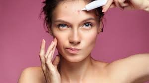 Why Pimples Appear Before Periods and What Experts Recommend for Prevention