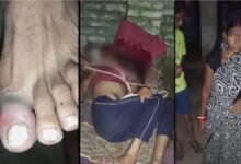 Woman Arrested After Allegedly Tying Husband to Cot and Giving Electric Shocks