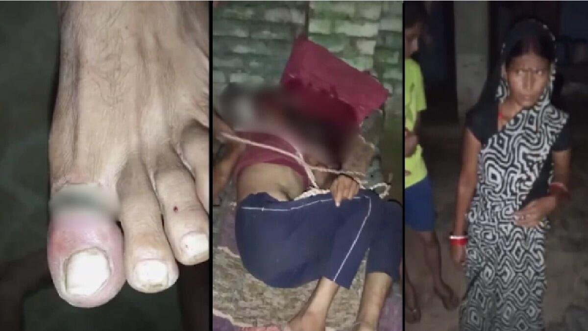 Woman Arrested After Allegedly Tying Husband to Cot and Giving Electric Shocks