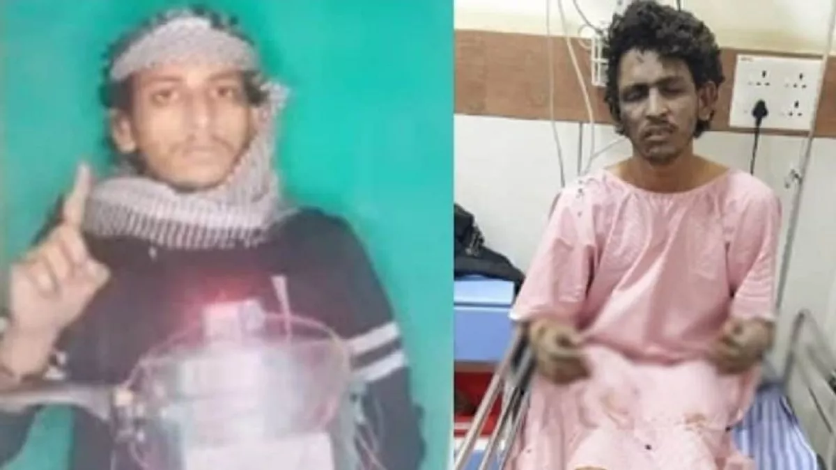 Mangaluru cooker blast case: Accused terrorist Shariq discharged from hospital